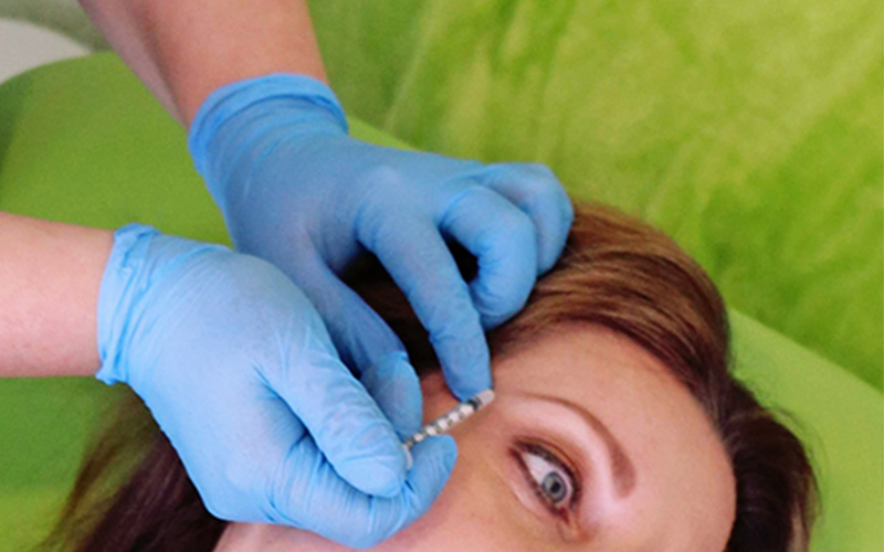 Anti Wrinkle treatment
