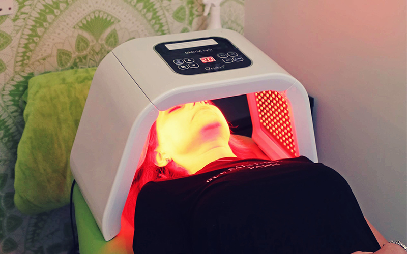 Radiofrequency treatment close up